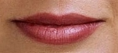 Chapped Lips
