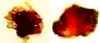 Ear Wax Picture