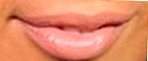 Fat lips