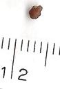Kidney stones image
