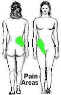 Kidney stone location and pain location