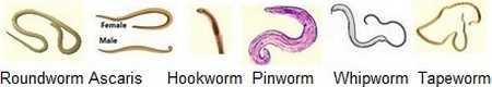worms in human - Roundworm, Ascaris worm, Hookworm, Whipworm, Tapeworm